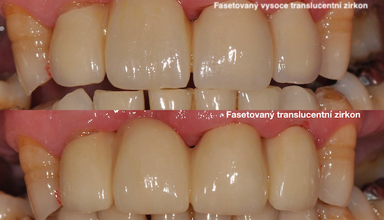 fasetovany-translucentni-zirkon